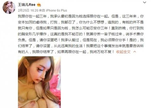 王瑞儿遭家暴